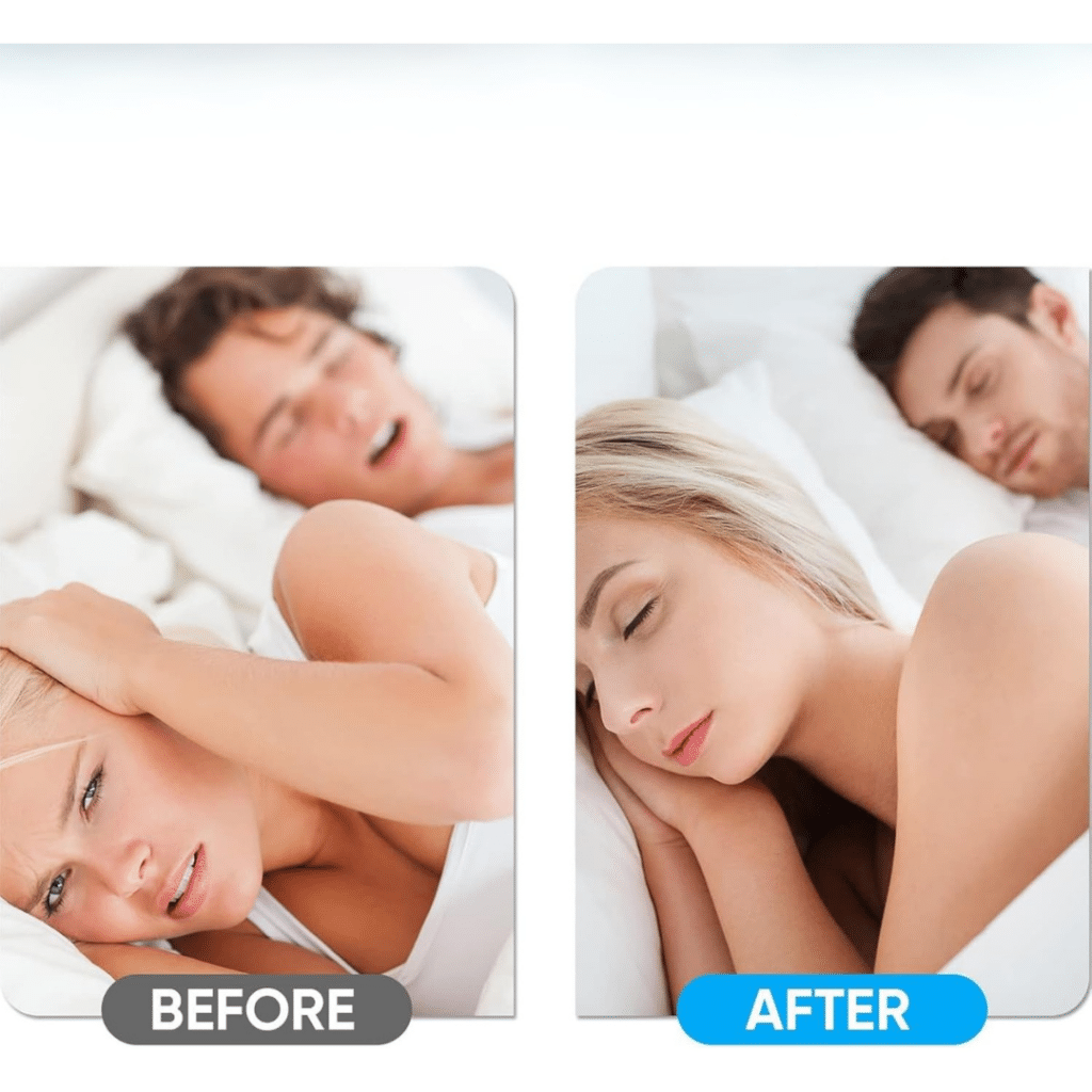 Snorno Ring (Official Retailer) [year]